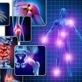 خطرات بیماری فیبرومیالژیا و راه‌های درمان فیبرومیالژیا